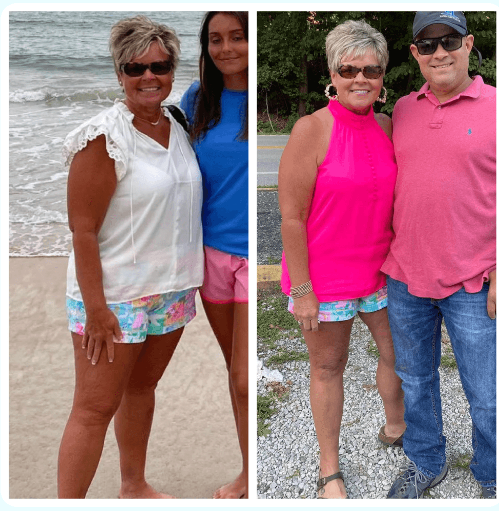 Revalee's before and after